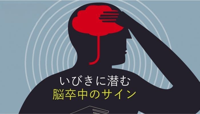 いびきに潜む脳卒中のサイン